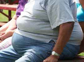 Cegah dan Hindari Obesitas Sejak Dini 